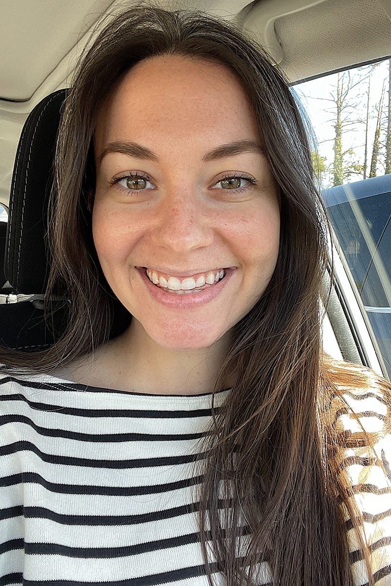 another round of Invisalign trays another round of Invisalign trays | DIARY No.53